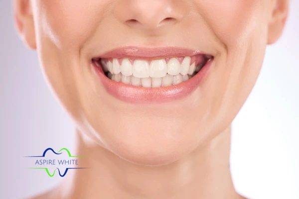 Follow your teeth whitening aftercare Preston to prolong your whiter smile!