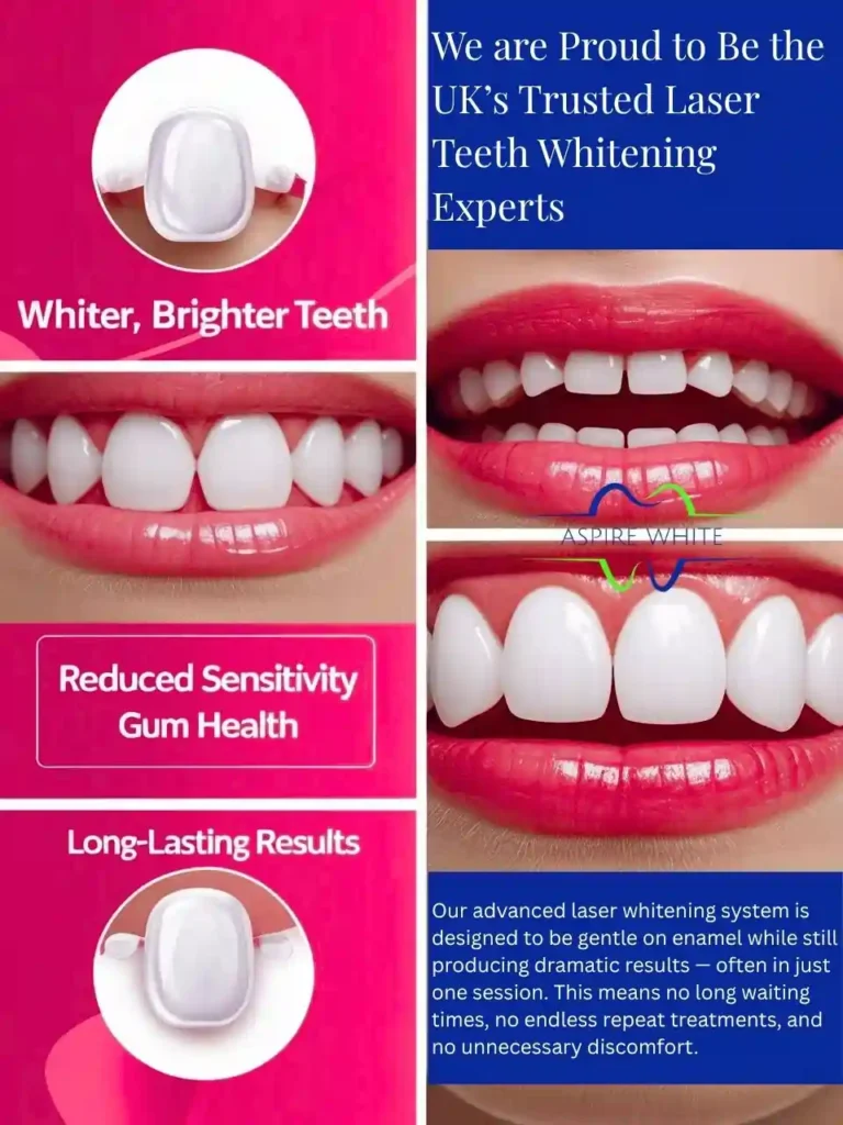We are Proud to Be the UK’s Trusted Laser Teeth Whitening Experts Preston